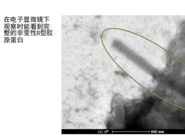 Lonza 非变性II型胶原蛋白（UC-II）与普通胶原蛋白的不一样之处在哪里?